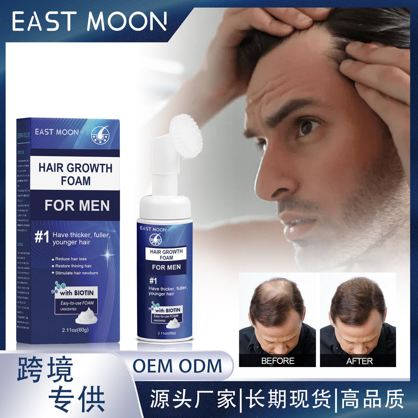 Men'S Hair Regeneration Care Minodil and Biotin Sparse Hair &Male Hair Loss Care