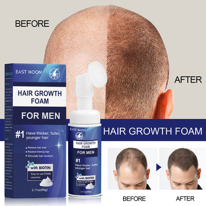 Men'S Hair Regeneration Care Minodil and Biotin Sparse Hair &Male Hair Loss Care