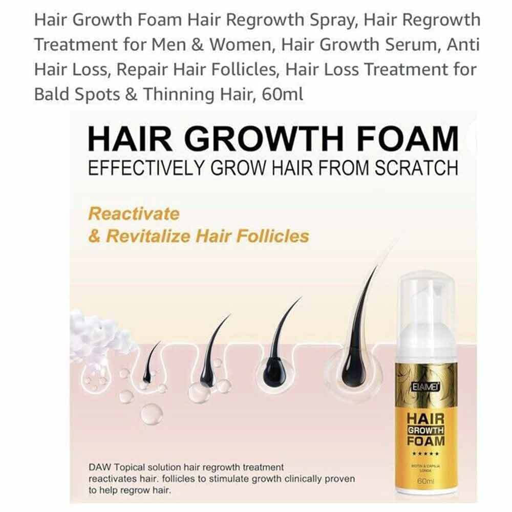 Hair Growth Moussmi Hair Growth Moisturizing Scalp anti Loss Hair Care 60Ml 2024