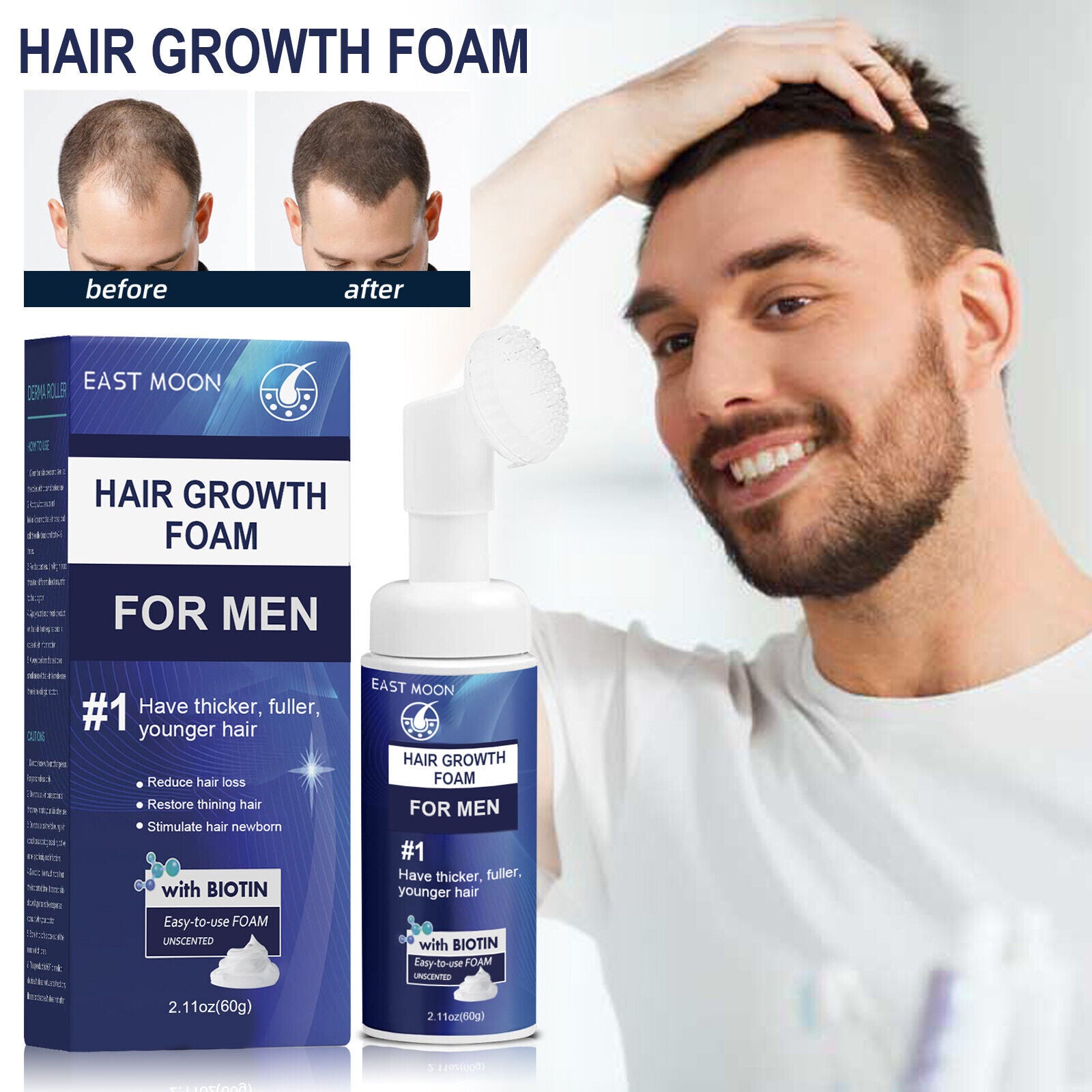 Men'S Hair Regeneration Care Minodil and Biotin Sparse Hair &Male Hair Loss Care