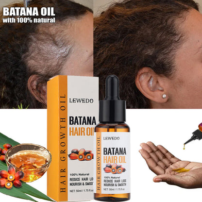 Natural 100% Batana Oil for Hair Growth Hair Loss Treatment Men&Women Hair Care