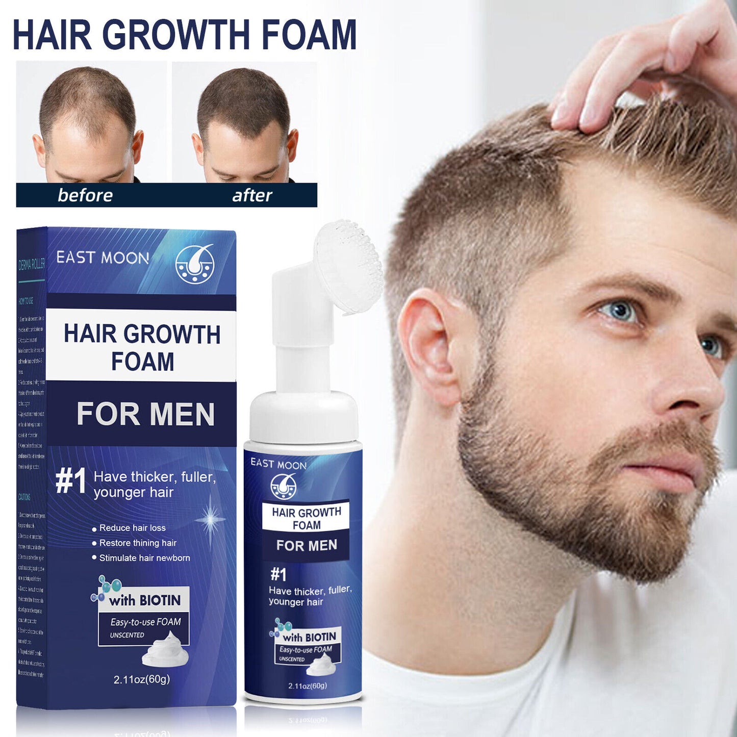 Men'S Hair Regeneration Care Minodil and Biotin Sparse Hair &Male Hair Loss Care